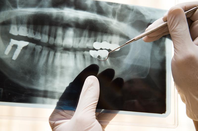 Dental Imaging